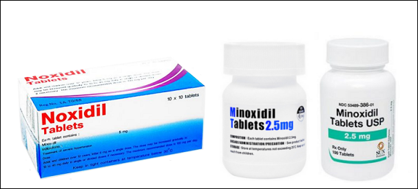 ミノキシジルタブレットでほうれい線悪化