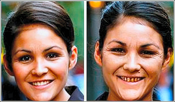 タバコで老け顔