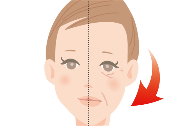 目元と頬のたるみ