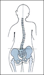 体の歪みでシワができる