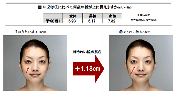 ほうれい線で6歳老ける