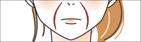 長いほうれい線