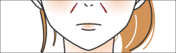 短いほうれい線