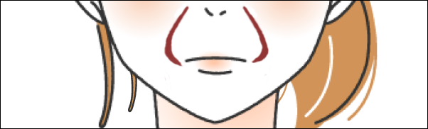 ほうれい線が口角に繋がっている