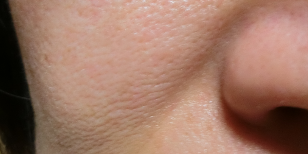 クリスタルコンプ使用3ヶ月後