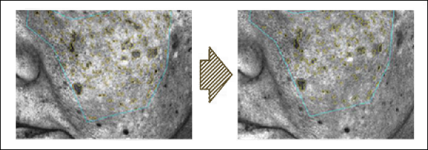 βカロテンでシミ改善