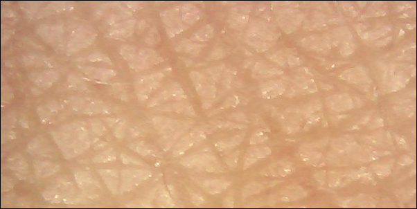 セラミドとほうれい線